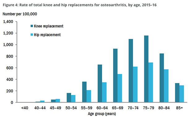 Osteoarthritis Exercises for Knee Pain